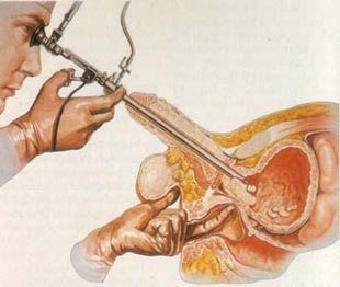 Organlar ne zaman yaşlanıyor? Organlar10