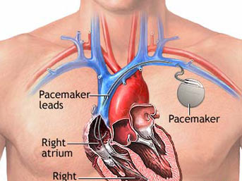 http://img5.mynet.com/ha5/analiz/tesaduf-icat16.jpg
