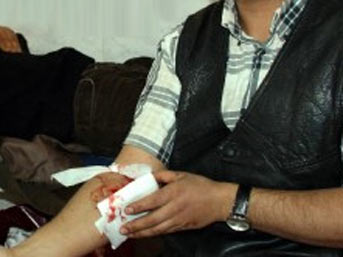 2 bin 365 acemi kasap hastanelik oldu