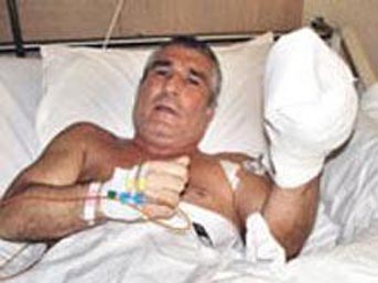 İşadamı Üstündağ'ın Uludağ'da parmağı koptu