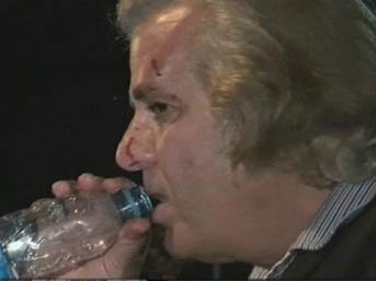 Tarık Akan'a biber gazlı, coplu saldırı