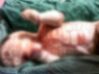 Ağrı'da 'yılan' bebek dünyaya geldi