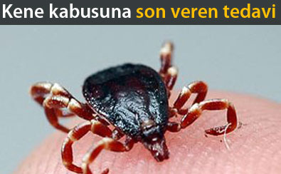 Kene kabusuna son veren tedavi