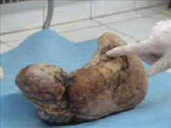 Kimsenin inanmadığı mucize bebek