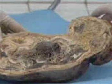 Kimsenin inanmadığı mucize bebek