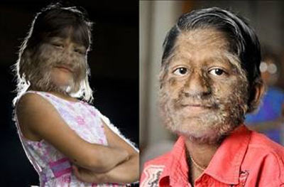 Kimsenin inanmadığı mucize bebek