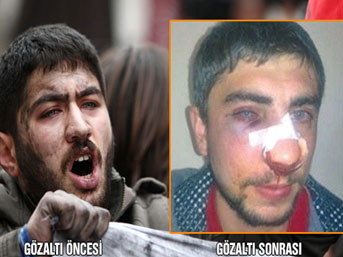 Polis portakal gazı mı kullandı?