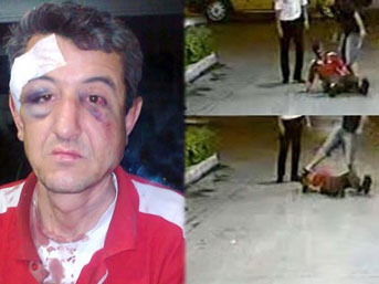 Antalya&#39;da bir benzin istasyonunda pompacı olarak çalışan 39 yaşındaki bir çocuk babası Derviş Mehmet Alp, kendisini dövüp hastanelik eden polis memurundan ... - pompaci-dayak1